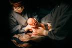 C-section deliveries becoming common