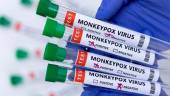File photo: Test tubes labelled Monkeypox virus positive and negative are seen in this illustration taken May 23, 2022. REUTERSpix