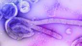 Pix for visual purposes only (Electron microscopic image of the 1976 isolate of Ebola virus) - UNSPLASHPIX
