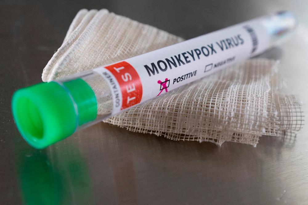 Test tube labelled “Monkeypox virus positive” are seen in this illustration taken May 22, 2022. REUTERSPIX