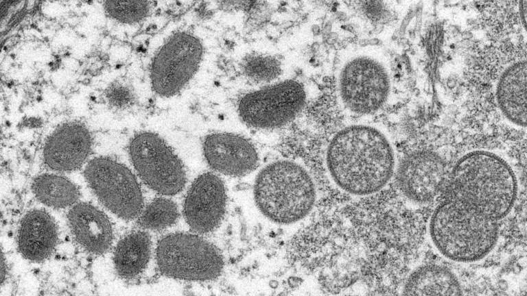 An electron microscopic (EM) image shows mature, oval-shaped monkeypox virus particles as well as crescents and spherical particles of immature virions, obtained from a clinical human skin sample associated with the 2003 prairie dog outbreak in this undated image obtained by Reuters on May 18, 2022. Cynthia S. Goldsmith, Russell Regnery/CDC/Handout via REUTERSpix