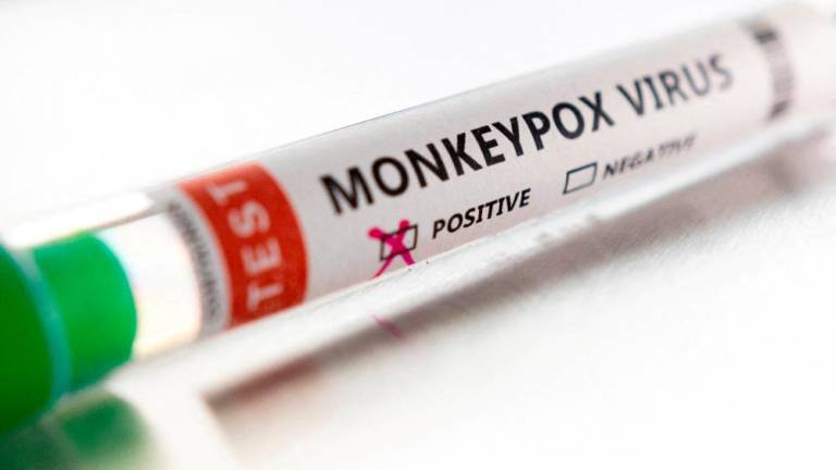 File photo: Test tube labelled Monkeypox virus positive is seen in this illustration taken May 22, 2022. REUTERSpix
