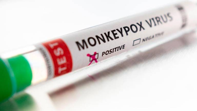 Test tube labelled Monkeypox virus positive are seen in this illustration taken May 22, 2022. REUTERSpix