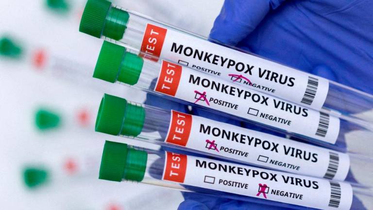 File photo: Test tubes labelled Monkeypox virus positive and negative are seen in this illustration taken May 23, 2022. REUTERSpix