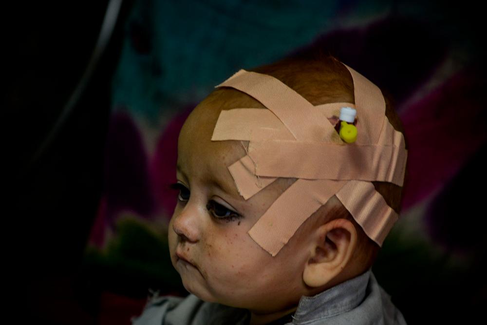 An Afghan child is treated inside a hospital in the city of Sharan after getting injured in an earthquake in Gayan district, Paktika province on June 22, 2022. AFPPIX